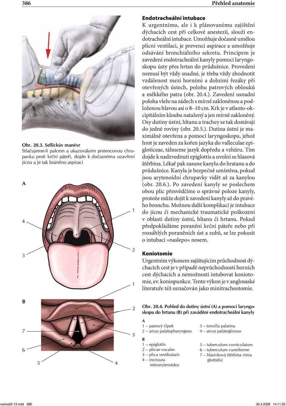 k plánovanému zajištění dýchacích cest při celkové anestezii, slouží endotracheální intubace. Umožňuje dočasně umělou plicní ventilaci, je prevencí aspirace a umožňuje odsávání bronchiálního sekretu.