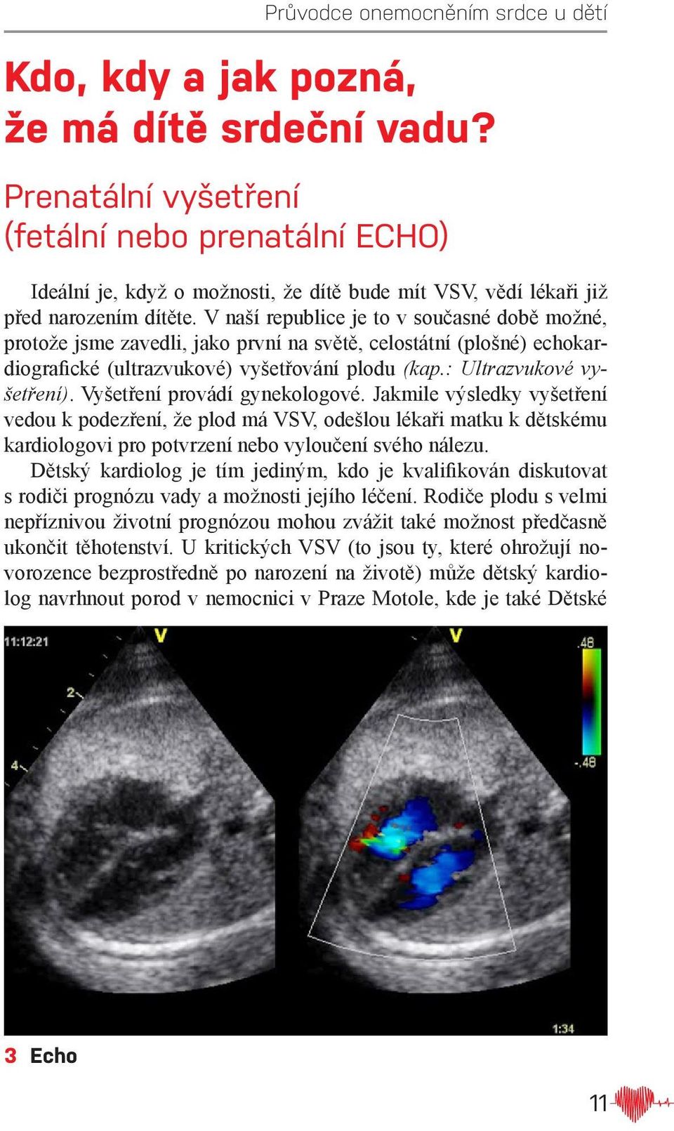 Vyšetření provádí gynekologové. Jakmile výsledky vyšetření vedou k podezření, že plod má VSV, odešlou lékaři matku k dětskému kardiologovi pro potvrzení nebo vyloučení svého nálezu.