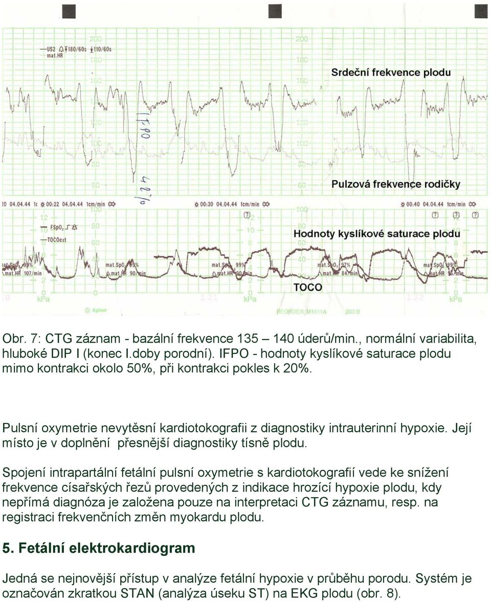 Její místo je v doplnění přesnější diagnostiky tísně plodu.