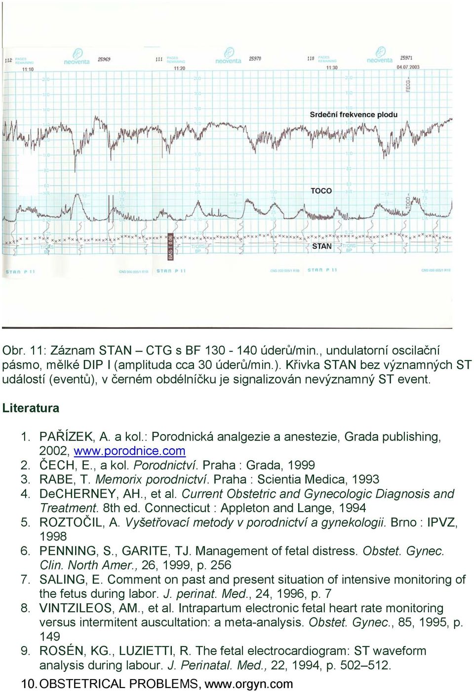 : Porodnická analgezie a anestezie, Grada publishing, 2002, www.porodnice.com 2. ČECH, E., a kol. Porodnictví. Praha : Grada, 1999 3. RABE, T. Memorix porodnictví. Praha : Scientia Medica, 1993 4.