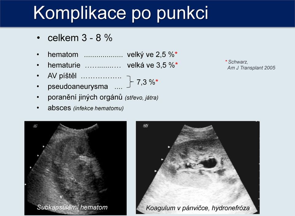 .. * Schwarz, Am J Transplant 2005 poranění jiných orgánů (střevo,