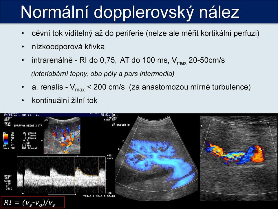 max 20-50cm/s (interlobární tepny, oba póly a pars intermedia) a.