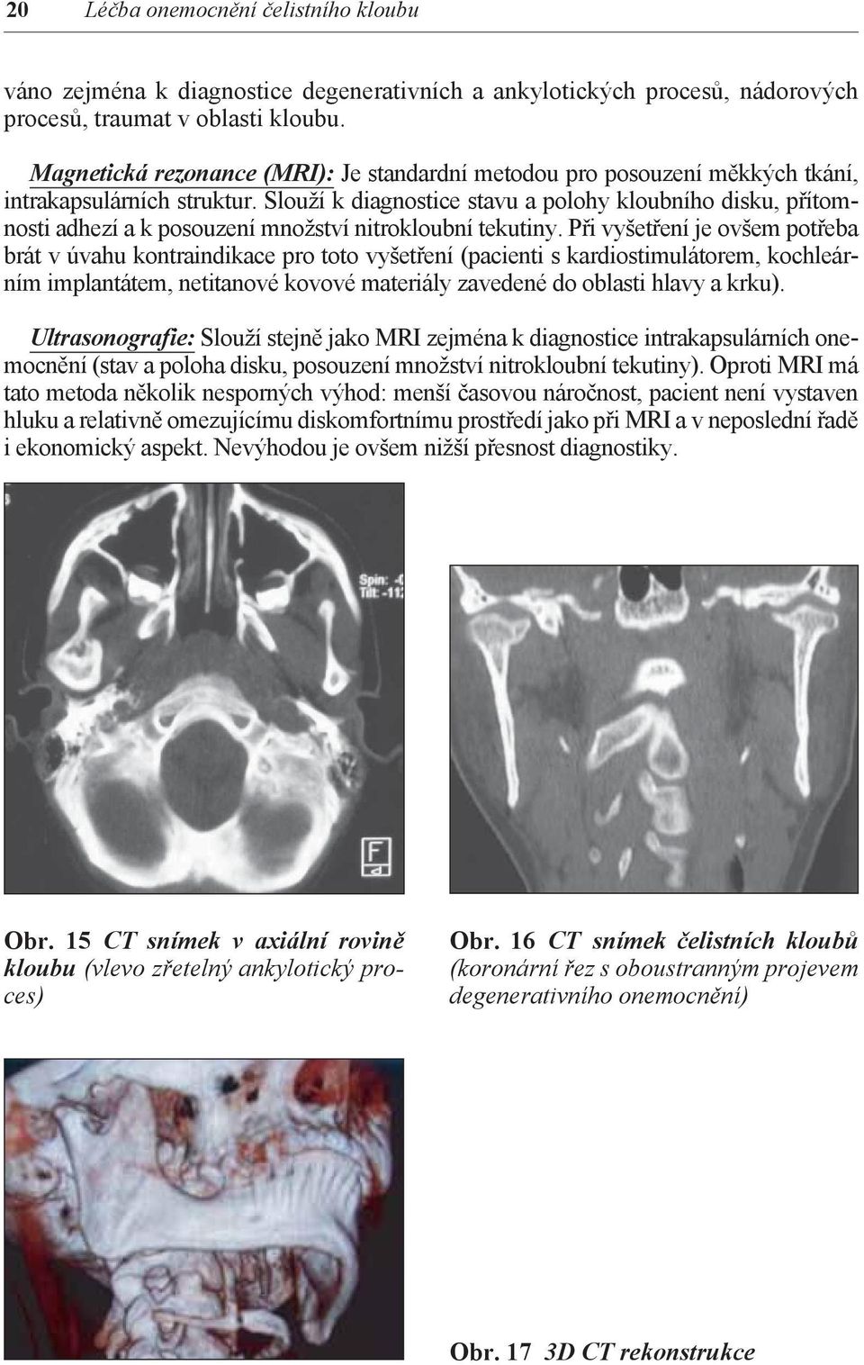 Slouží k diagnostice stavu a polohy kloubního disku, přítomnosti adhezí a k posouzení množství nitrokloubní tekutiny.