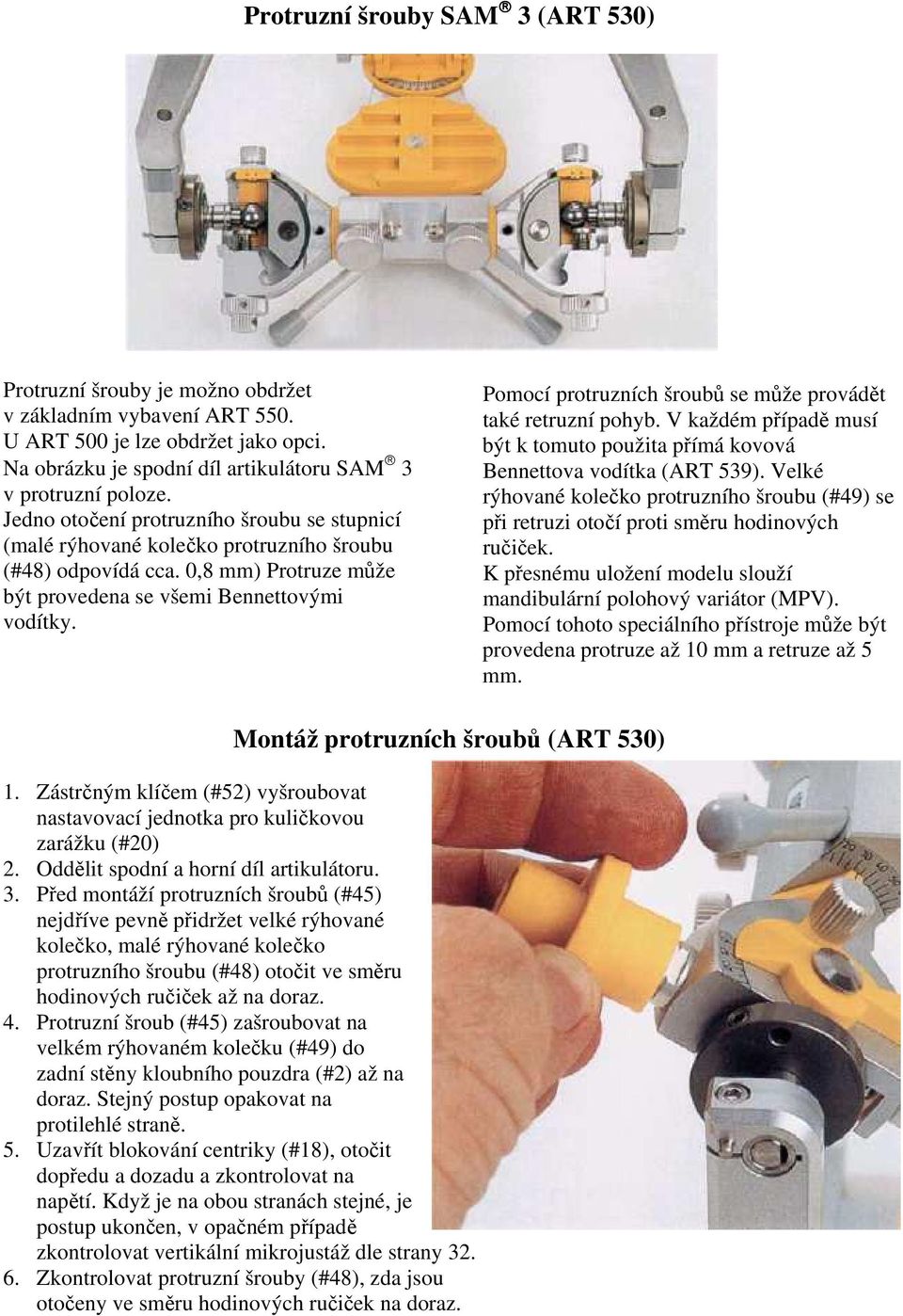 Pomocí protruzních šroubů se může provádět také retruzní pohyb. V každém případě musí být k tomuto použita přímá kovová Bennettova vodítka (ART 539).