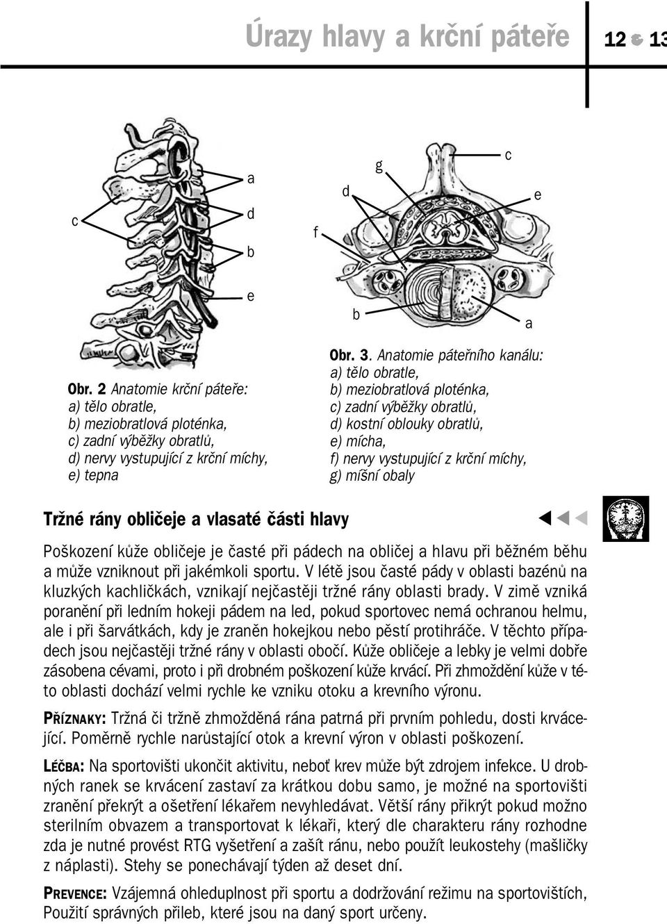 Anatomie páteřního kanálu: a) tělo obratle, b) meziobratlová ploténka, c) zadní výběžky obratlů, d) kostní oblouky obratlů, e) mícha, f) nervy vystupující z krční míchy, g) míšní obaly Tržné rány