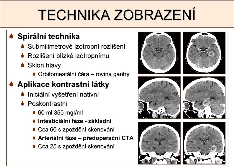 látky Iniciální vyšetření nativní Poskontrastní 60 ml 350 mgi/ml Intesticiální fáze -