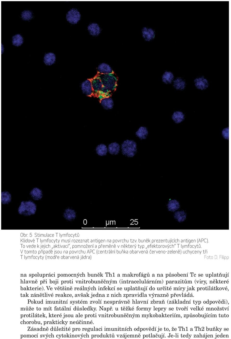 V tomto případě jsou na povrchu APC (centrální buňka obarvená červeno-zeleně) uchyceny tři T lymfocyty (modře obarvená jádra) Foto D.