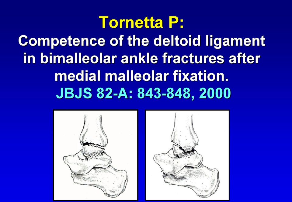 ankle fractures after medial