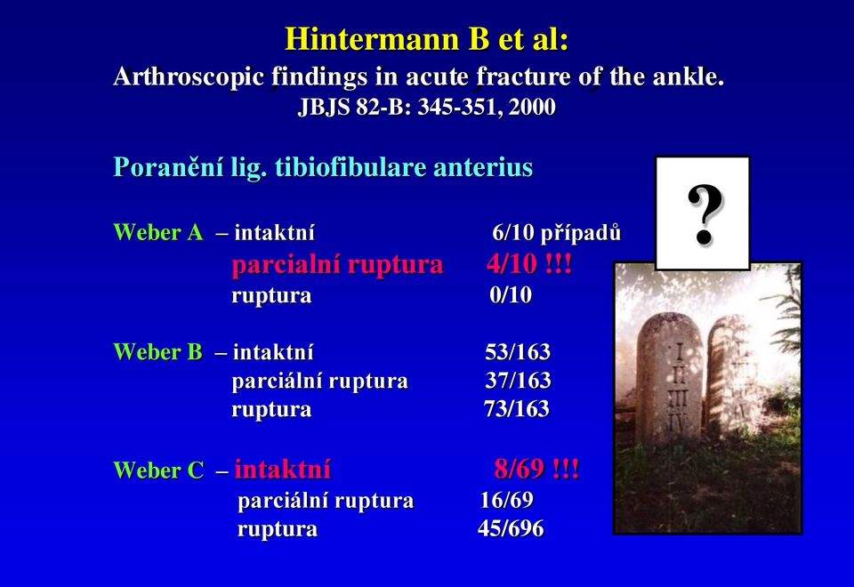 tibiofibulare anterius Weber A intaktní 6/10 případů parcialní ruptura 4/10!