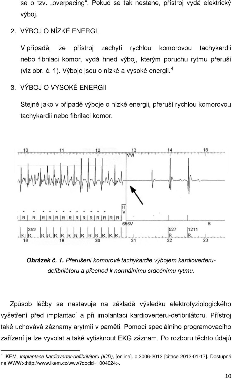 Výboje jsou o nízké a vysoké energii. 4 3. VÝBOJ O VYSOKÉ ENERGII Stejně jako v případě výboje o nízké energii, přeruší rychlou komorovou tachykardii nebo fibrilaci komor. Obrázek č. 1.