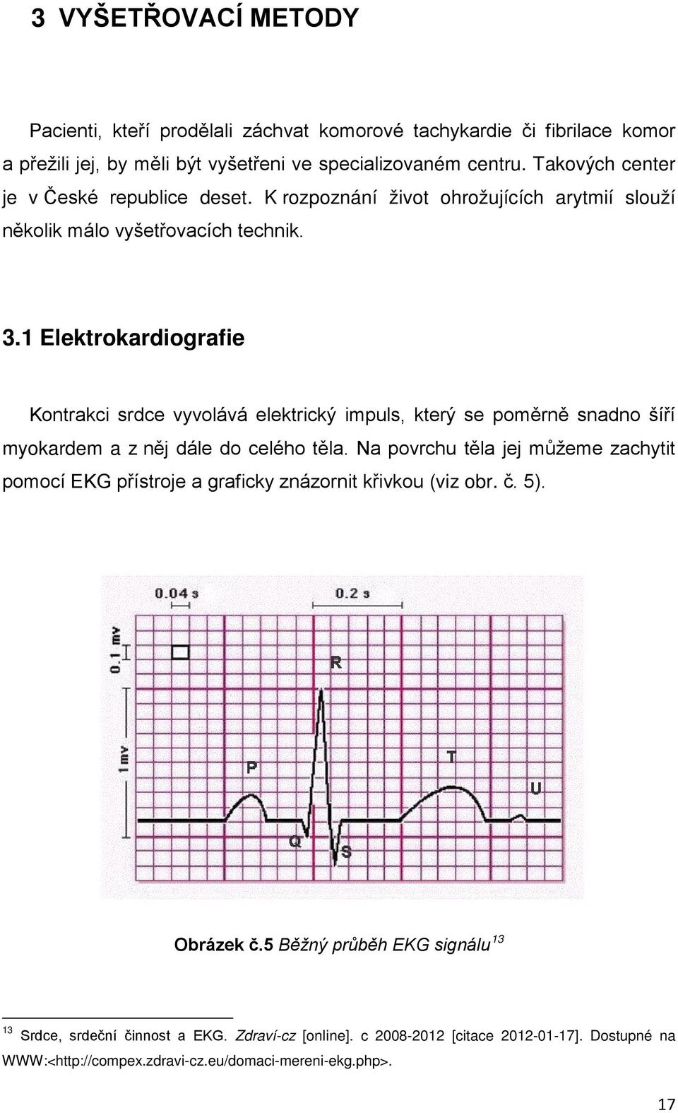 1 Elektrokardiografie Kontrakci srdce vyvolává elektrický impuls, který se poměrně snadno šíří myokardem a z něj dále do celého těla.
