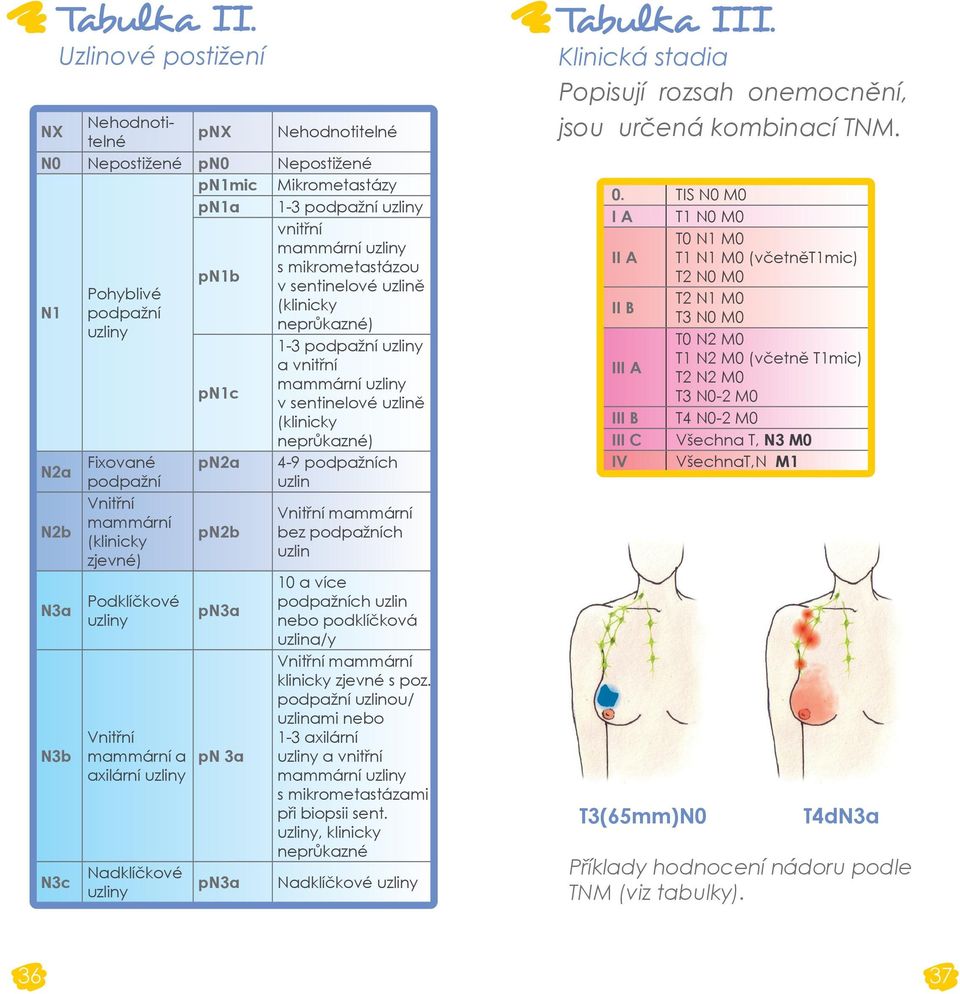 uzlině Pohyblivé (klinicky podpažní neprůkazné) uzliny 1-3 podpažní uzliny a vnitřní pn1c mammární uzliny v sentinelové uzlině (klinicky neprůkazné) N2a Fixované pn2a 4-9 podpažních podpažní uzlin