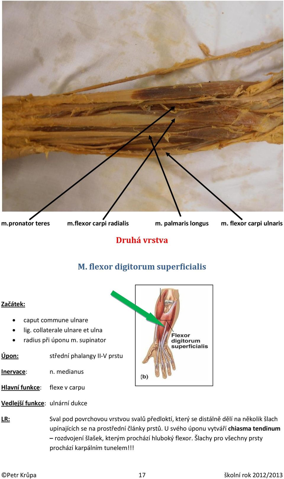 medianus flexe v carpu Vedlejší funkce: ulnární dukce Sval pod povrchovou vrstvou svalů předloktí, který se distálně dělí na několik šlach upínajících