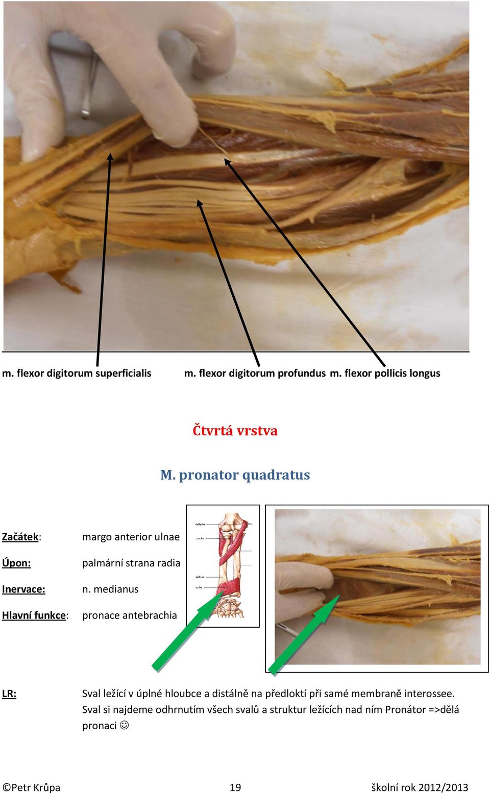 pronator quadratus margo anterior ulnae palmární strana radia n.