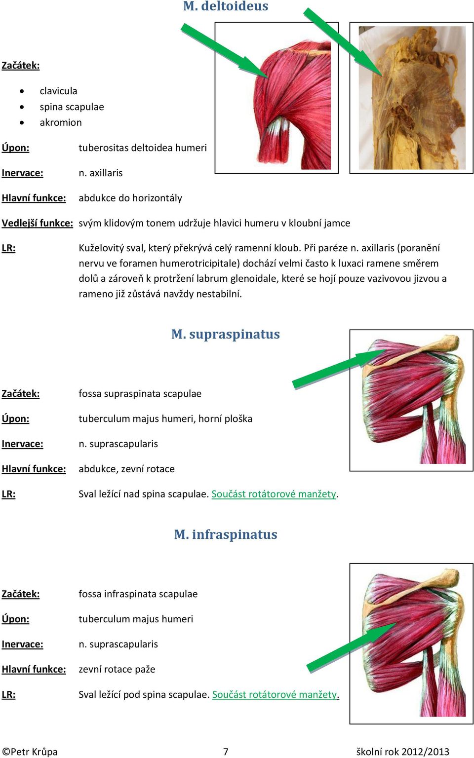 axillaris (poranění nervu ve foramen humerotricipitale) dochází velmi často k luxaci ramene směrem dolů a zároveň k protržení labrum glenoidale, které se hojí pouze vazivovou jizvou a rameno již