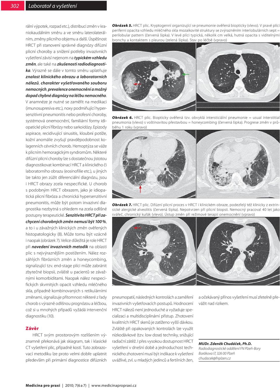 HRCT plic technika vyšetření, CT anatomie, základní typy patologických  nálezů - PDF Stažení zdarma