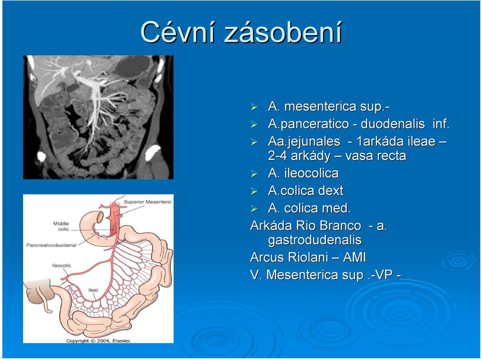 jejunales - 1arkáda ileae 2-44 arkády vasa recta A.
