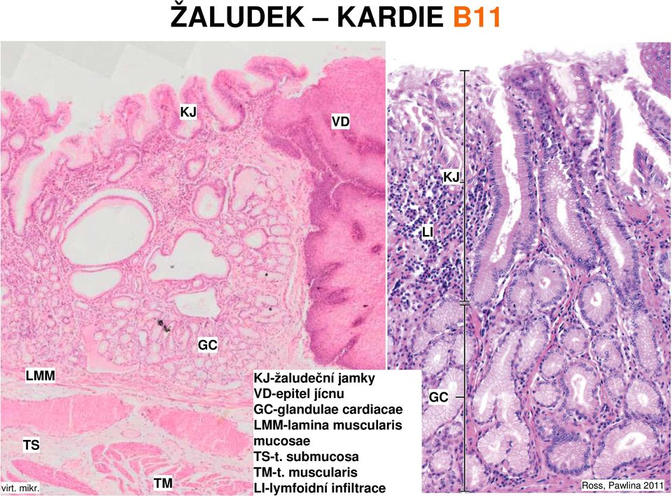 muscularis mucosae TS-t. submucosa TM-t.