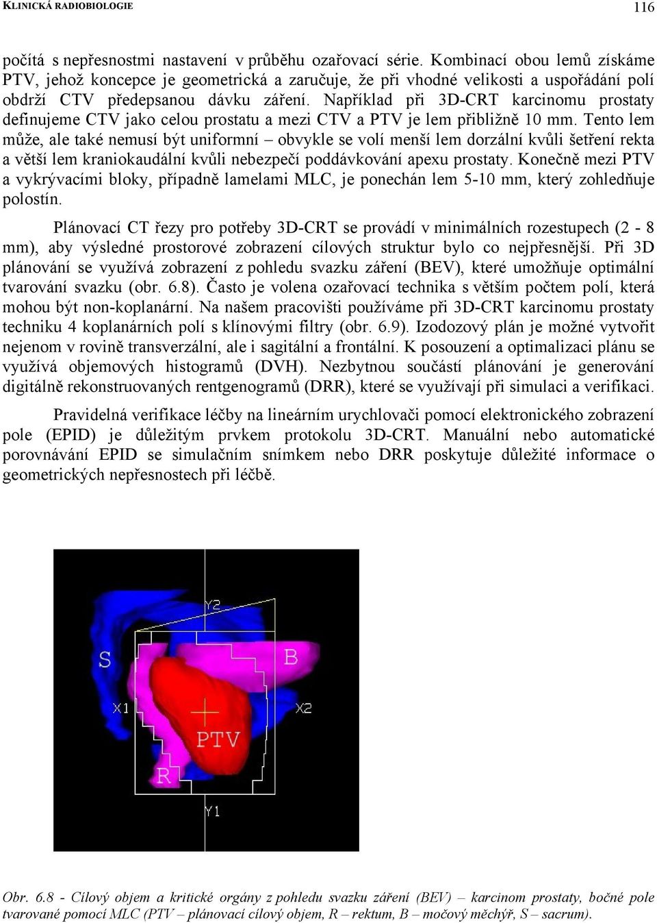 Například při 3D-CRT karcinomu prostaty definujeme CTV jako celou prostatu a mezi CTV a PTV je lem přibližně 10 mm.