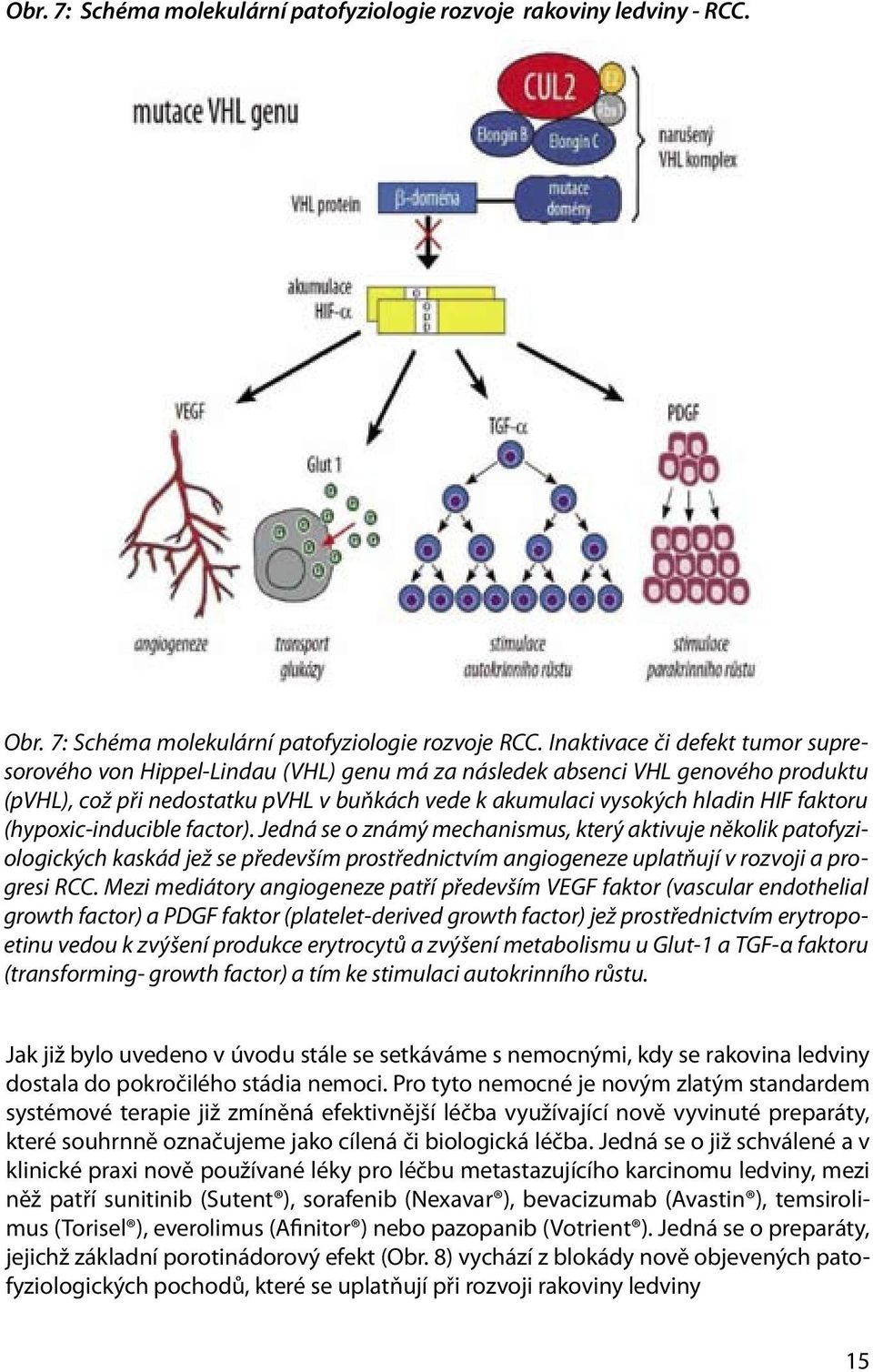 faktoru (hypoxic-inducible factor). Jedná se o známý mechanismus, který aktivuje několik patofyziologických kaskád jež se především prostřednictvím angiogeneze uplatňují v rozvoji a progresi RCC.