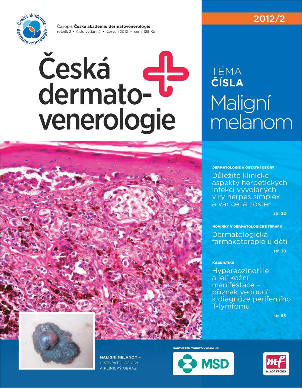 zoster str. 22 Novinky v dermatologické terapii Dermatologická farmakoterapie u dětí str.