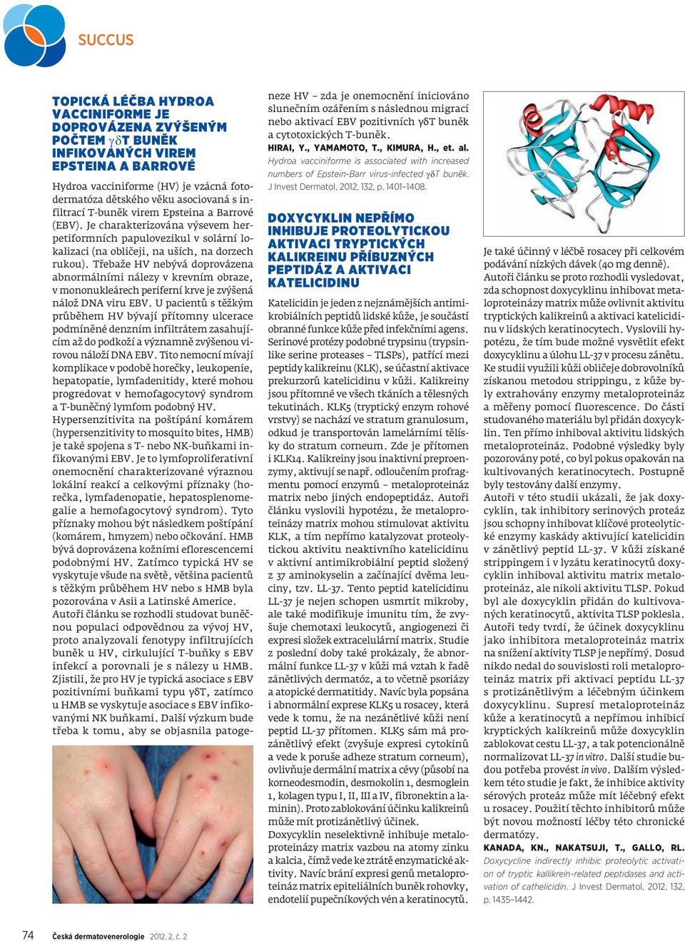 Třebaže HV nebývá doprovázena abnormálními nálezy v krevním obraze, v mononukleárech periferní krve je zvýšená nálož DNA viru EBV.