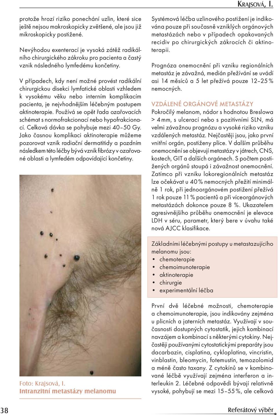 V případech, kdy není možné provést radikální chirurgickou disekci lymfatické oblasti vzhledem k vysokému věku nebo interním komplikacím pacienta, je nejvhodnějším léčebným postupem aktinoterapie.