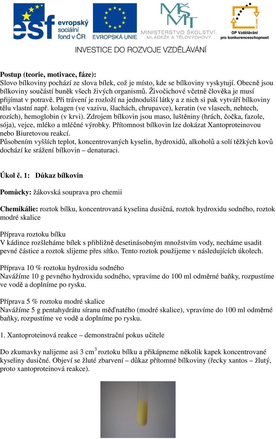 kolagen (ve vazivu, šlachách, chrupavce), keratin (ve vlasech, nehtech, rozích), hemoglobin (v krvi). Zdrojem bílkovin jsou maso, luštěniny (hrách, čočka, fazole, sója), vejce, mléko a mléčné výrobky.