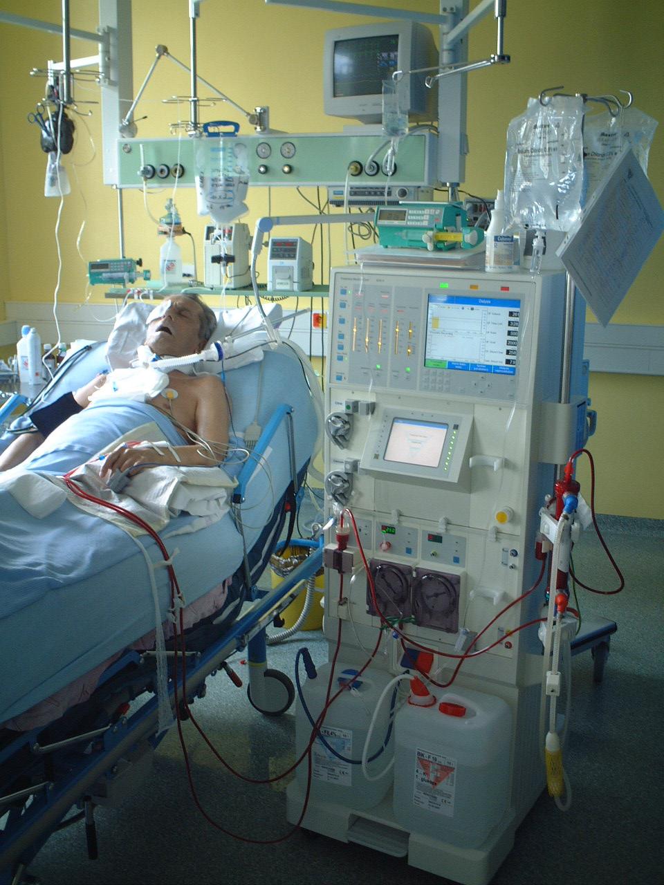 Je prováděna každý den nebo v pravidelných intervalech jako u chronicky dialyzovaných pacientů ob den nebo třikrát týdně Pracuje na