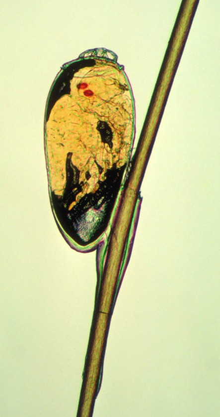 Pediculus capitis (veš dětská,