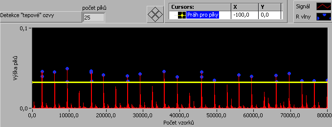 Další část tohoto programu (obr. 8.21) nám detekuje první ozvu, která je graficky znázorněna v grafu (obr. 8.22). Na blok Ramp Pattern, který nám generuje pole obsahující rampa vzor.