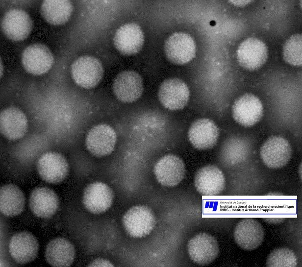 STŘEVNÍ ADENOVIRY Č: Adenoviridae neobalené DNA viry 51 sérotypů