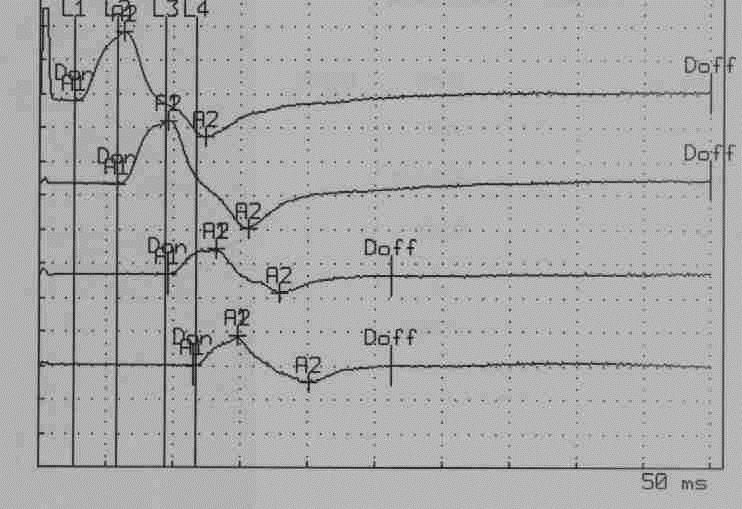 Partial block of n.