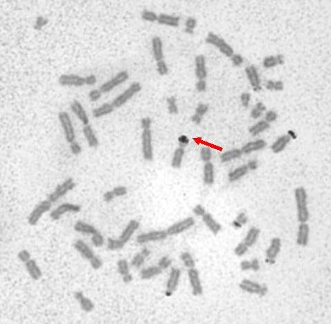 JADÉRKO přítomnost jadérka v interfázním jádře a jeho nepřítomnost v mitóze souvisí se spiralizací a despiralizací akrocentrických chromosomů interfázní jádro 10 dekondenzovaných akrocentrických