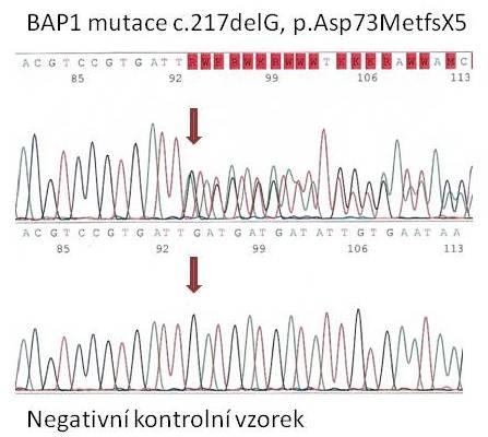 genu: mutace c.