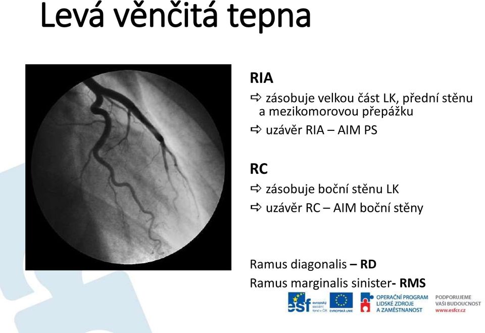 AIM PS RC zásobuje boční stěnu LK uzávěr RC AIM