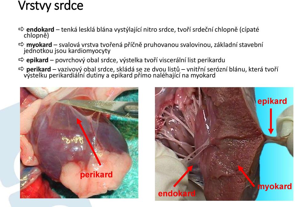 obal srdce, výstelka tvoří viscerální list perikardu perikard vazivový obal srdce, skládá se ze dvou listů vnitřní