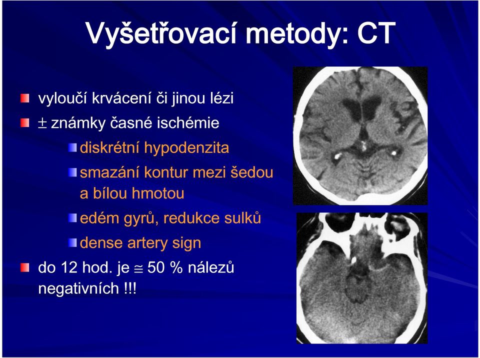 kontur mezi šedou a bílou hmotou edém gyrů, redukce