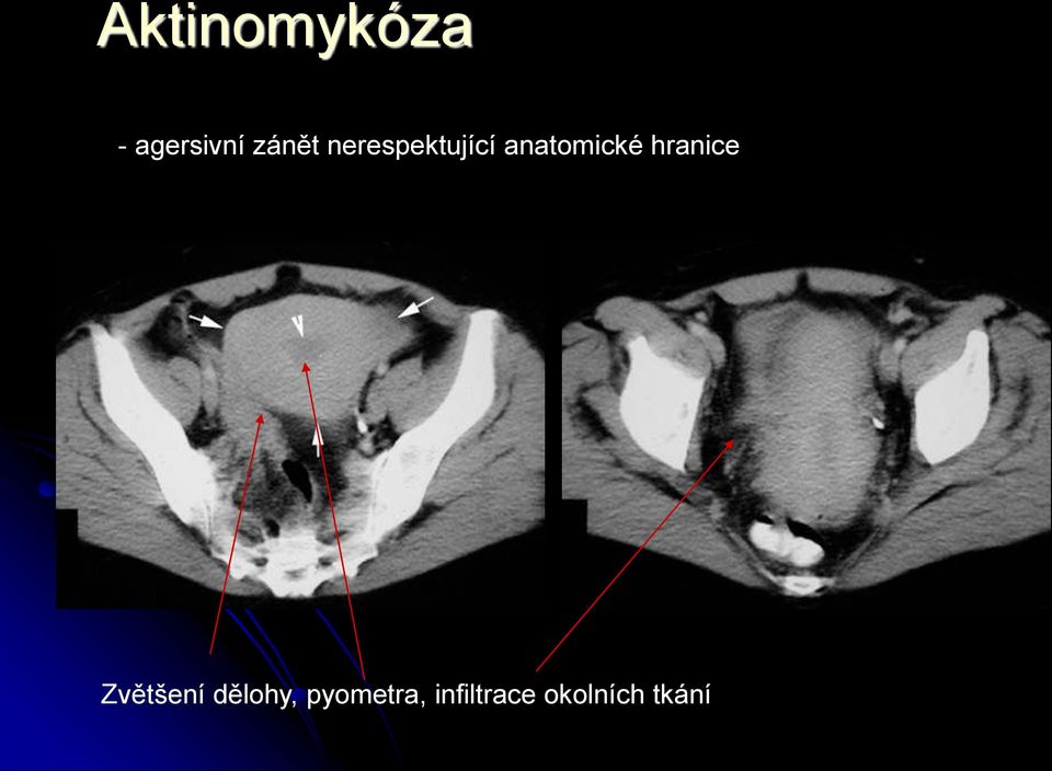 anatomické hranice Zvětšení