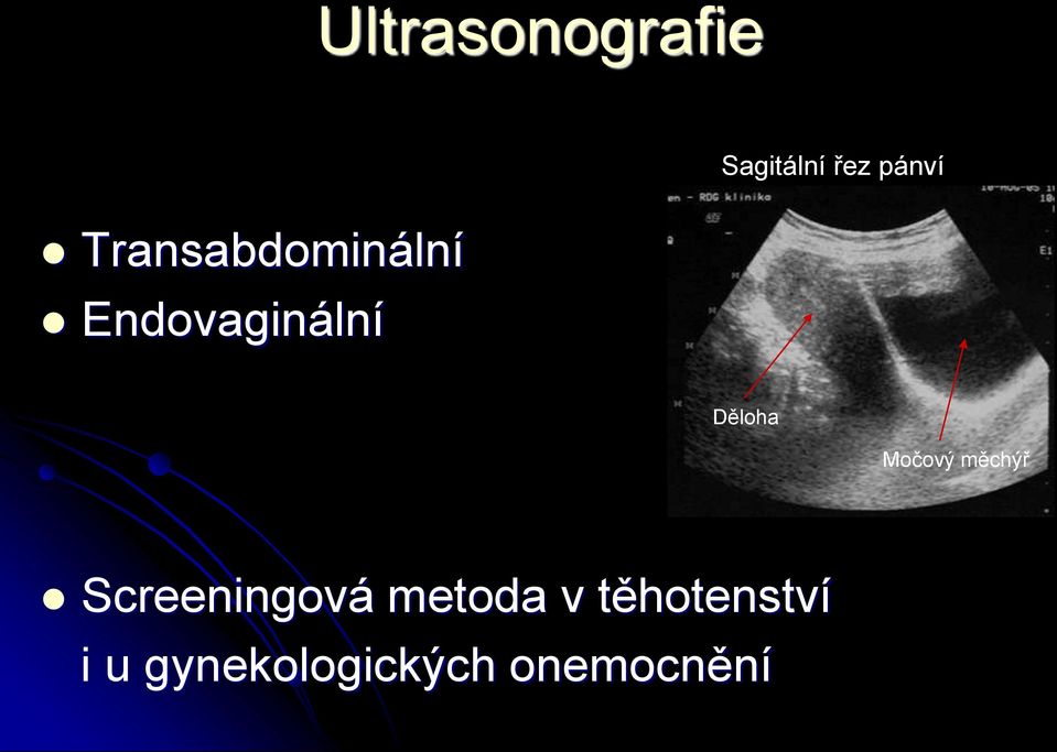 Děloha Močový měchýř Screeningová