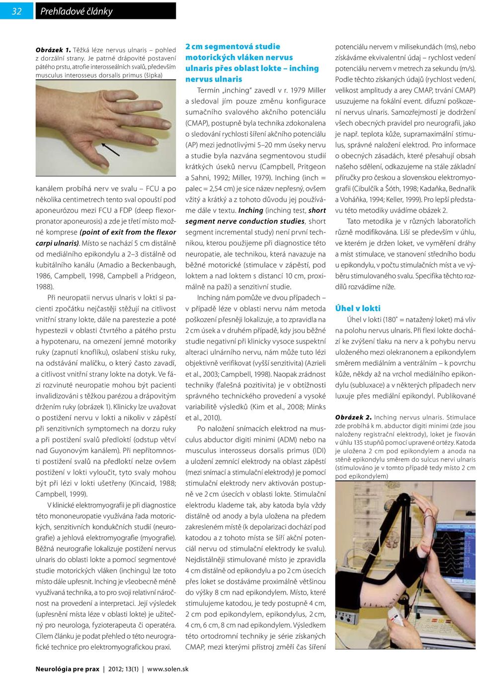 sval opouští pod aponeurózou mezi FCU a FDP (deep flexorpronator aponeurosis) a zde je třetí místo možné komprese (point of exit from the flexor carpi ulnaris).