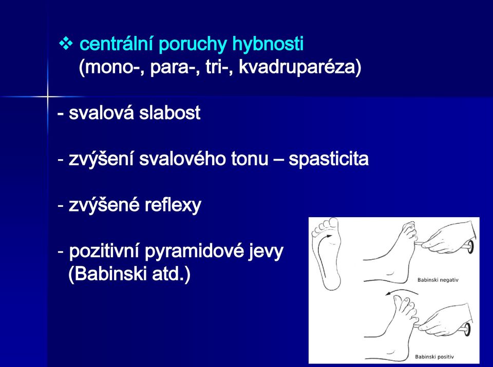 zvýšení svalového tonu spasticita - zvýšené