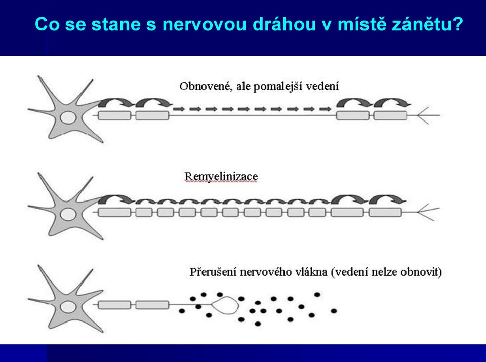 dráhou v