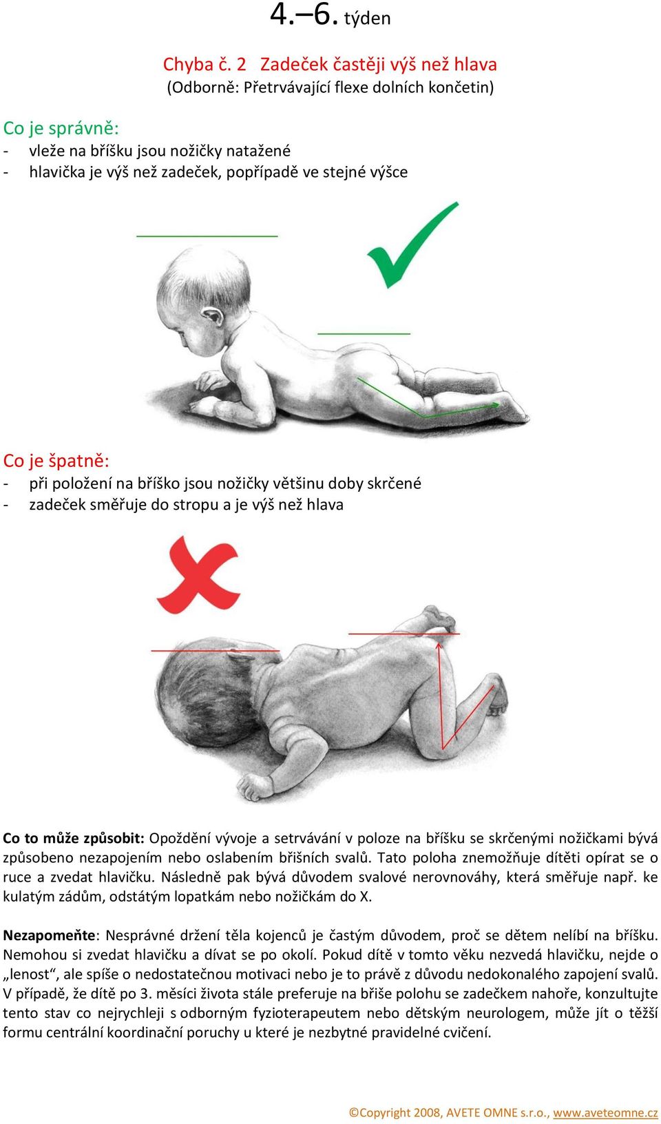 bříško jsou nožičky většinu doby skrčené - zadeček směřuje do stropu a je výš než hlava Co to může způsobit: Opoždění vývoje a setrvávání v poloze na bříšku se skrčenými nožičkami bývá způsobeno