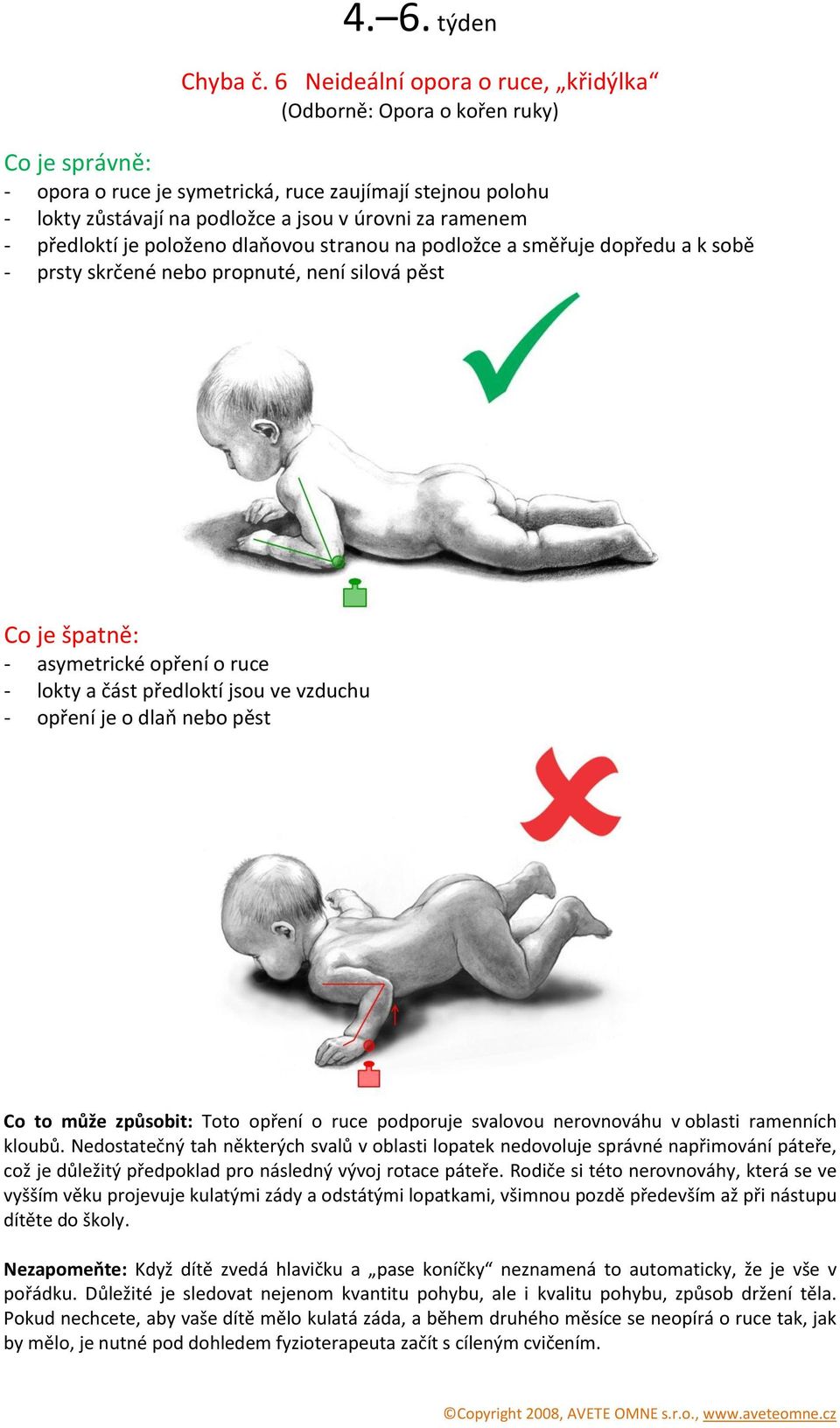 položeno dlaňovou stranou na podložce a směřuje dopředu a k sobě - prsty skrčené nebo propnuté, není silová pěst - asymetrické opření o ruce - lokty a část předloktí jsou ve vzduchu - opření je o