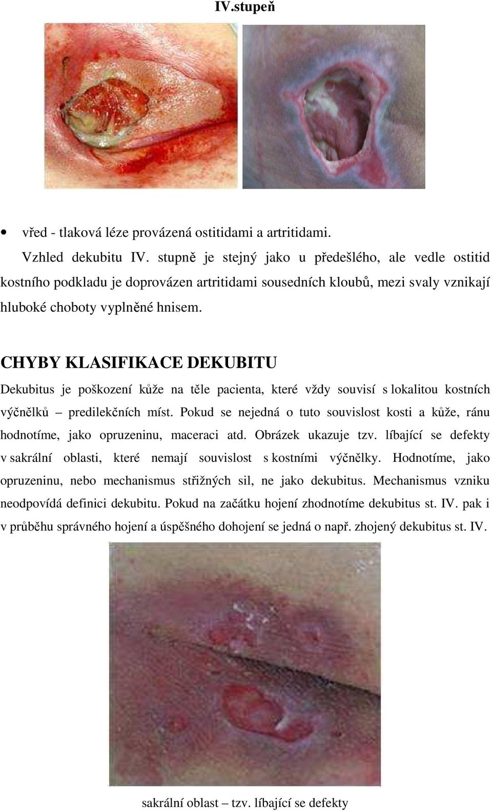CHYBY KLASIFIKACE DEKUBITU Dekubitus je poškození kůže na těle pacienta, které vždy souvisí s lokalitou kostních výčnělků predilekčních míst.