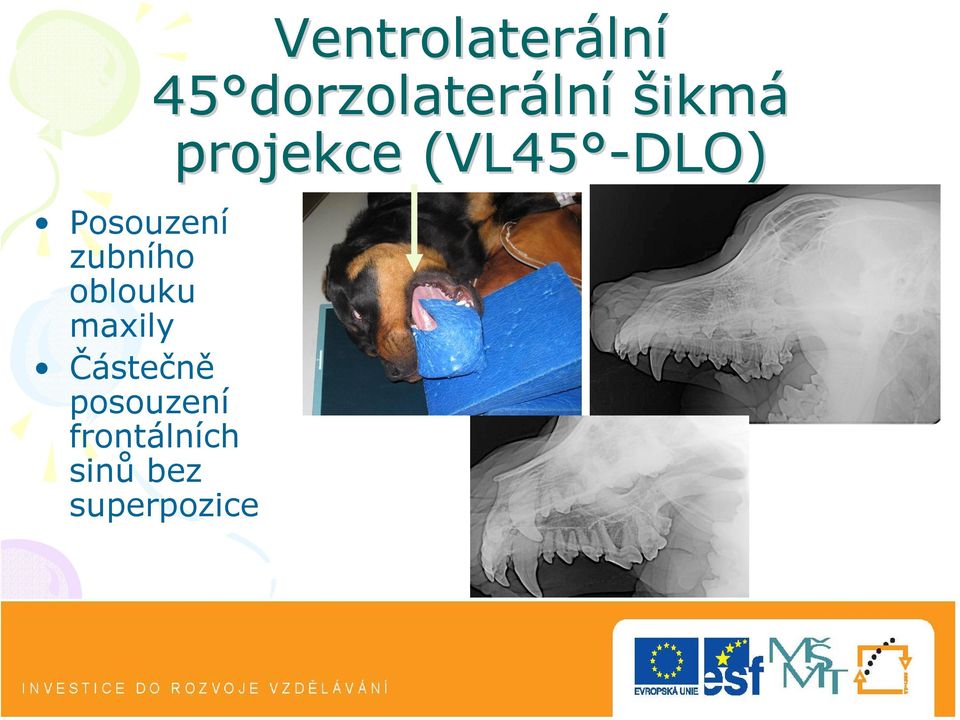 bez superpozice Ventrolaterální 45