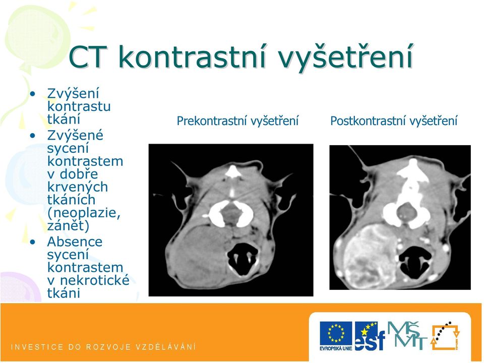 (neoplazie, zánět) Absence sycení kontrastem v