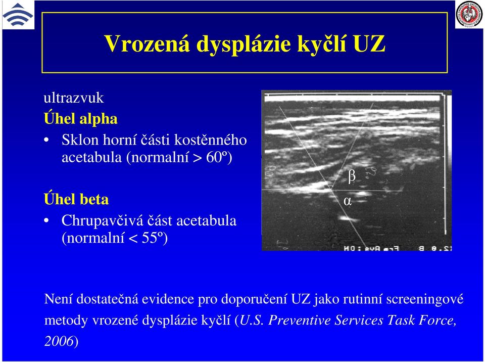 55º) α β Není dostatečná evidence pro doporučení UZ jako rutinní