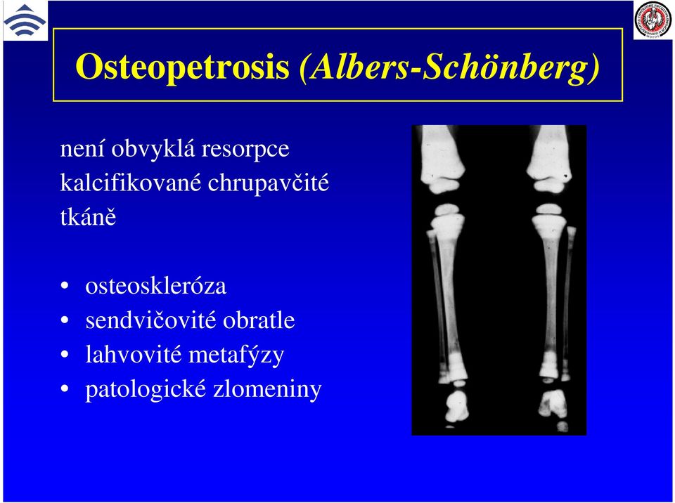 chrupavčité tkáně osteoskleróza